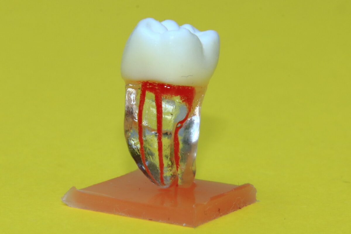 Donji molar 2