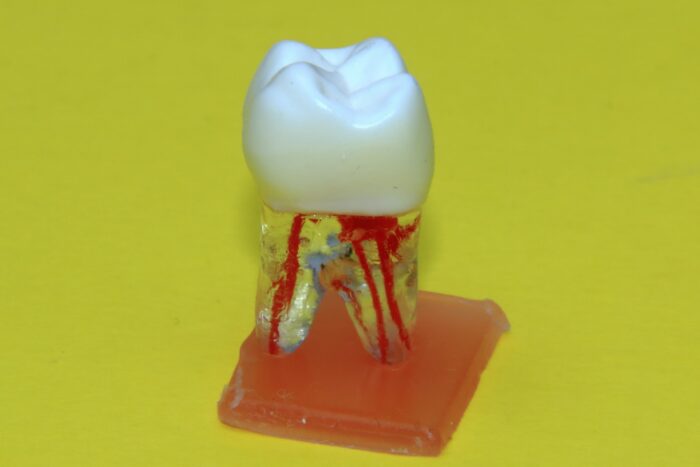 modeli-zuba