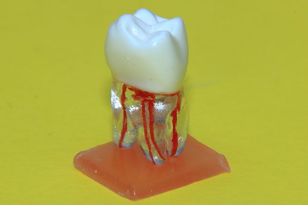Gornji molar
